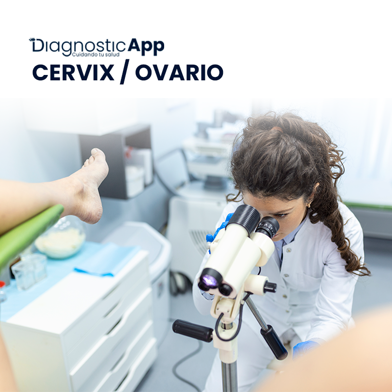 CERVIX / OVARIO